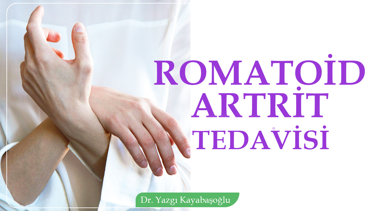 Romatoid Artrit Tedavisi bloğunu seç Romatoid Artrit Tedavisi